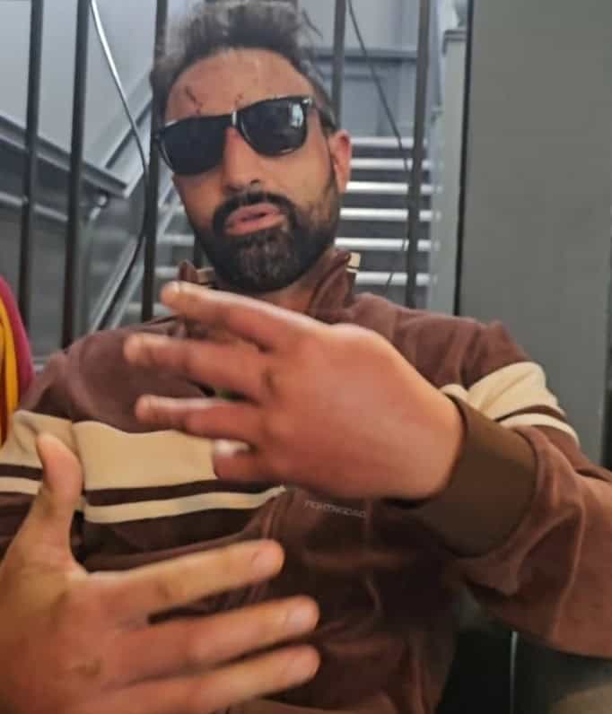 Paulie Malignaggi shows off damaged hands from bare knuckle return