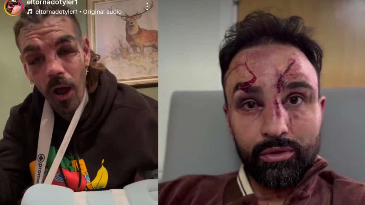 Malignaggi vs Goodjohn injuries