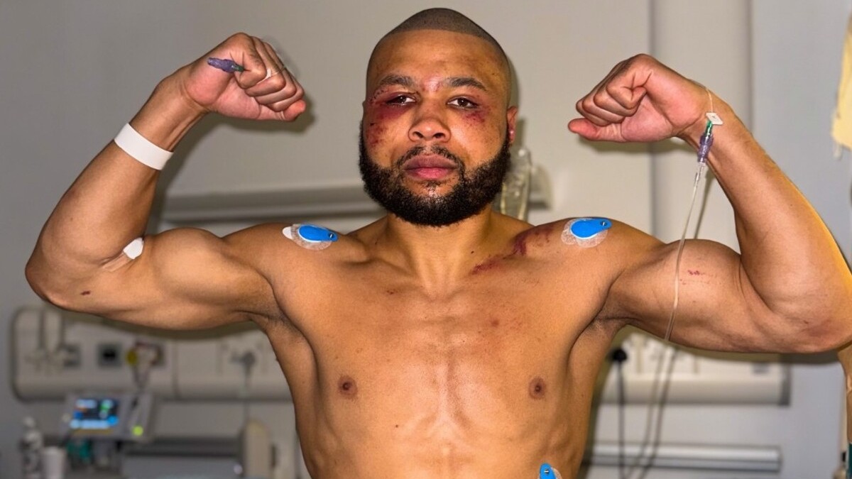 Eubank Jr.’s Mangled Face Ignites Fury Over Ambulance Delay
